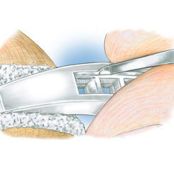 Characteristics of platinum alloys, and best practices for working with platinum, including tools and avoiding contamination