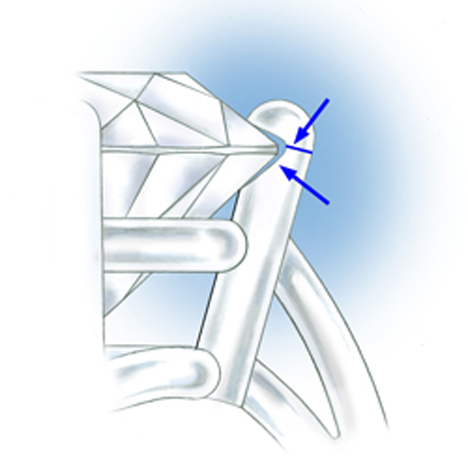 この爪は削り過ぎで、取付溝に隙間が見えます。