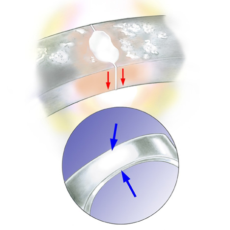 結合部の下側の熱により、はんだを流し込み母材に接合し、仕上がったリングには、はんだの継ぎ目は見られません。