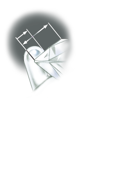 プラチナプロングがあるリングのセッティングの品質を評価します