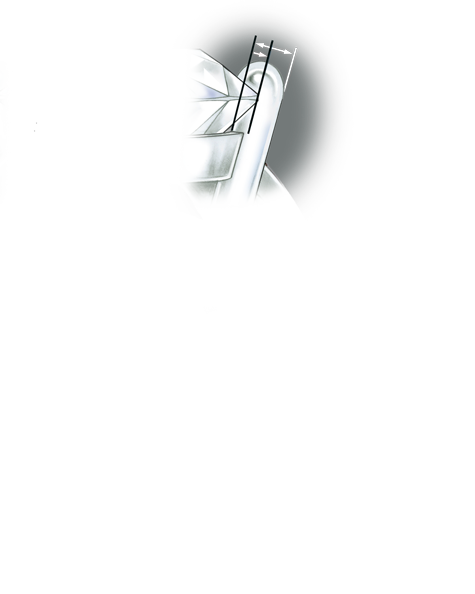 プラチナプロングがあるリングのセッティングの品質を評価します