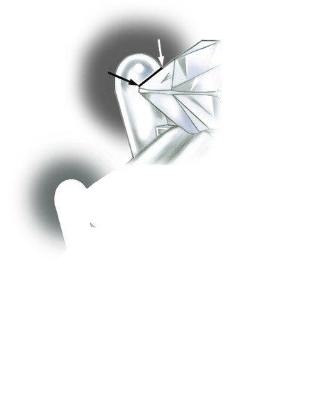 プラチナプロングがあるリングのセッティングの品質を評価します