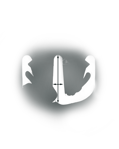 Quality Assurance Benchmarks highlight workmanship of semi-finished and finished platinum jewelry. Consumers are more satisfied with their jewelry when diamonds or other stones do not loosen or become dislodged. These two examples illustrate methods for evaluating the quality and durability of platinum prongs and settings.