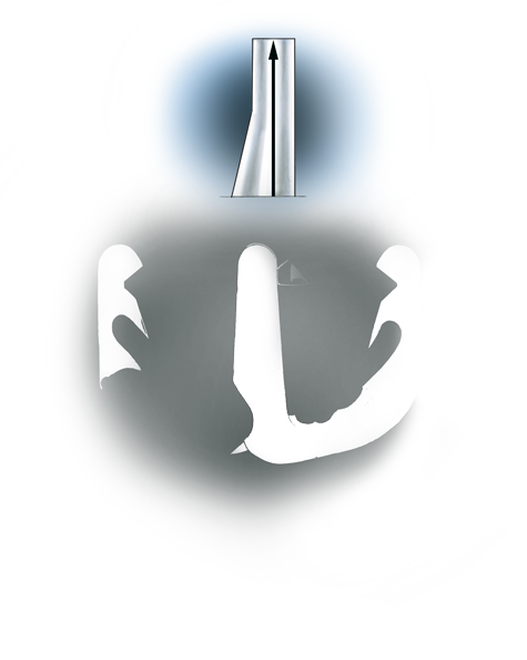 Quality Assurance Benchmarks highlight workmanship of semi-finished and finished platinum jewelry. Consumers are more satisfied with their jewelry when diamonds or other stones do not loosen or become dislodged. These two examples illustrate methods for evaluating the quality and durability of platinum prongs and settings.