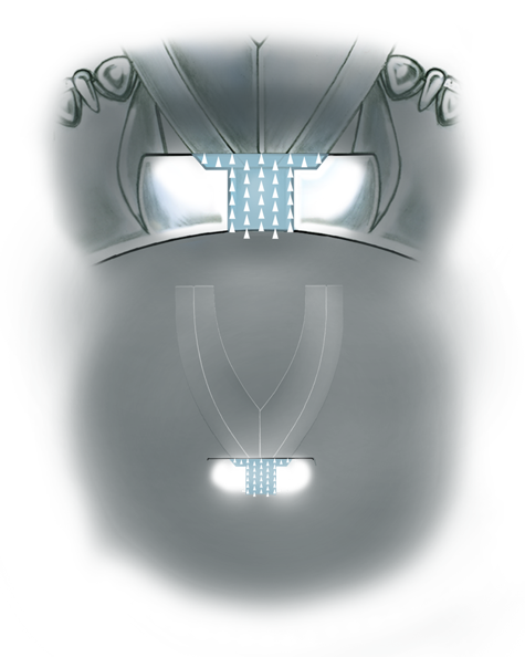 Evaluate the quality of a platinum ring mounting after its peg setting is replaced with another using these helpful illustrations and instructional video
