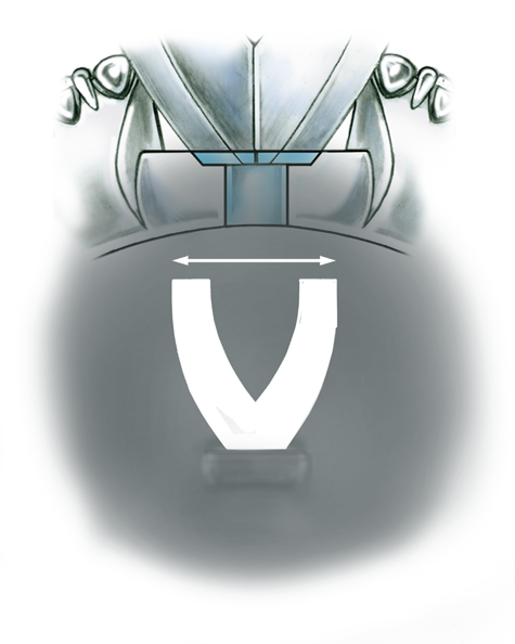 Evaluate the quality of a platinum ring mounting after its peg setting is replaced with another using these helpful illustrations and instructional video