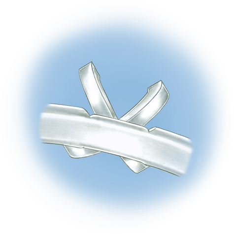 Evaluate the quality of a platinum ring mounting after its peg setting is replaced with another using these helpful illustrations and instructional video