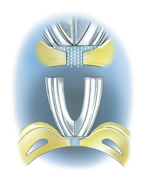 Learn how to evaluate the quality of a platinum ruthenium peg setting installation into a 14K yellow gold mounting with these helpful illustrations and instructional video