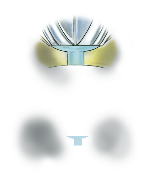 Learn how to evaluate the quality of a platinum ruthenium peg setting installation into a 14K yellow gold mounting with these helpful illustrations and instructional video