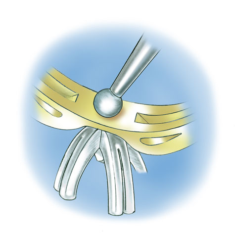Learn how to evaluate the quality of a platinum ruthenium peg setting installation into a 14K yellow gold mounting with these helpful illustrations and instructional video