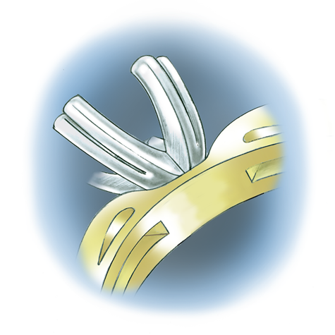 Learn how to evaluate the quality of a platinum ruthenium peg setting installation into a 14K yellow gold mounting with these helpful illustrations and instructional video
