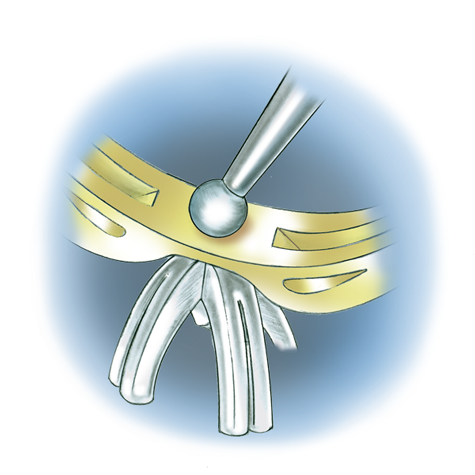 Learn how to evaluate the quality of a platinum ruthenium peg setting installation into a 14K yellow gold mounting with these helpful illustrations and instructional video