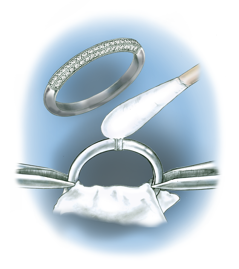 Learn how to evaluate the quality of a semi-finished assembled ring made from platinum cobalt components with these helpful illustrations and instructional video