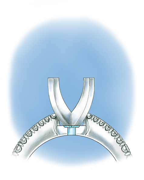 Illustration showing the side view of a platinum solitaire, with diamonds set in the shank