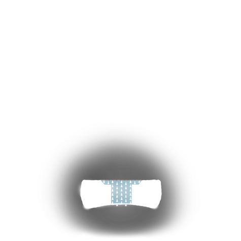 Evaluate the quality of a platinum ring mounting after its peg setting is replaced with another using these helpful illustrations and instructional video