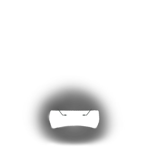 Evaluate the quality of a platinum ring mounting after its peg setting is replaced with another using these helpful illustrations and instructional video