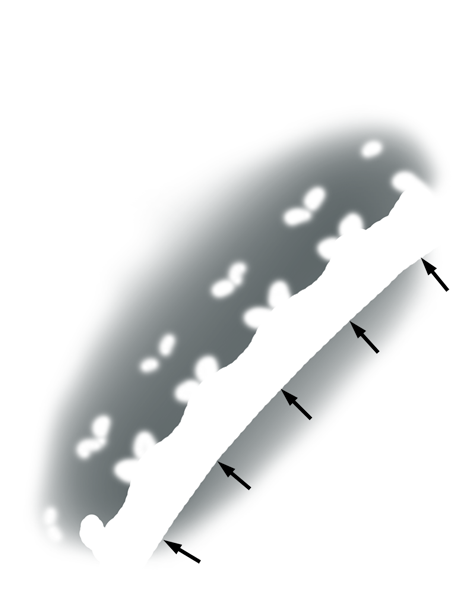 To maintain shank strength, there are no openings or drill holes beneath the settings. The bearings support the diamonds above the shank surface to allow for easier cleaning 