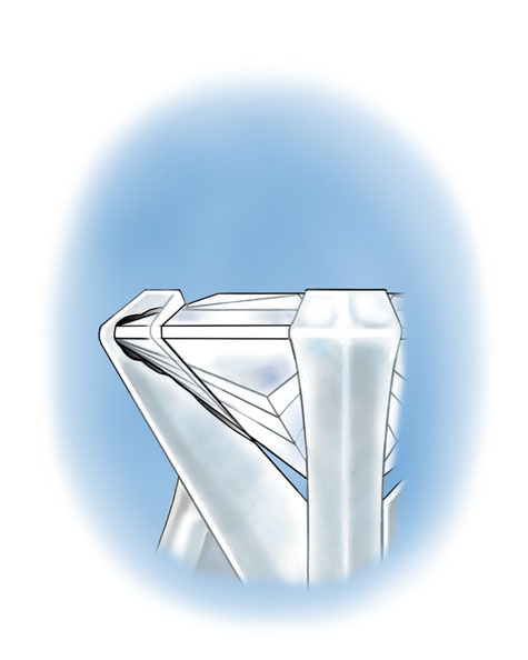 Close up cross-section illustration showing the chipped corner of a princess-cut platinum solitaire under the v-prong