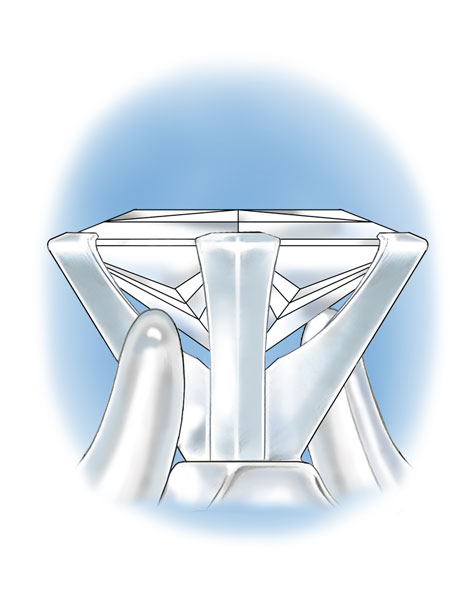 Learn how to evaluate the quality of a platinum setting for a princess-cut center stone with these helpful illustrations and instructional video