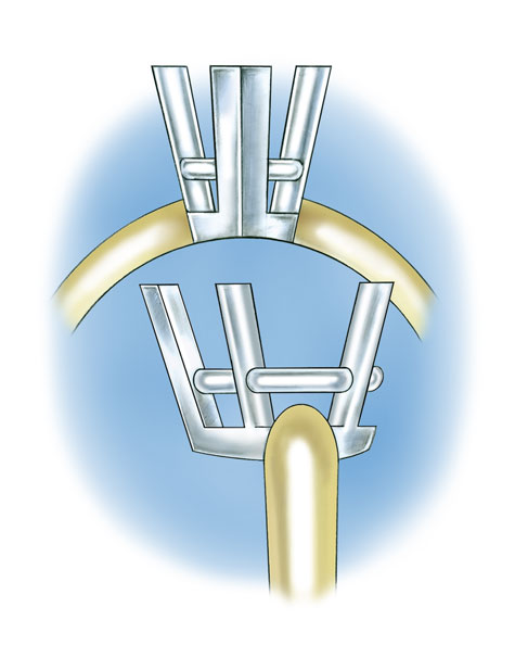 Four-prong, pear-shaped platinum cobalt setting with 14K yellow gold shank