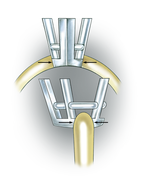 Learn how to evaluate the quality of a platinum cobalt pear-shaped setting installed onto a 14K yellow gold mounting with these helpful illustrations and instructional video.