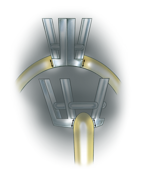 Learn how to evaluate the quality of a platinum cobalt pear-shaped setting installed onto a 14K yellow gold mounting with these helpful illustrations and instructional video.
