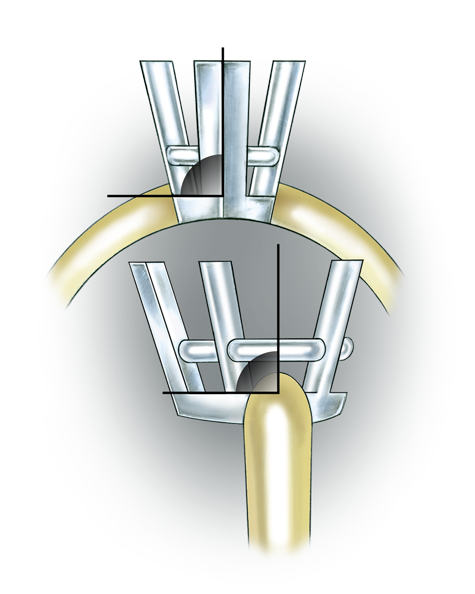 Learn how to evaluate the quality of a platinum cobalt pear-shaped setting installed onto a 14K yellow gold mounting with these helpful illustrations and instructional video.